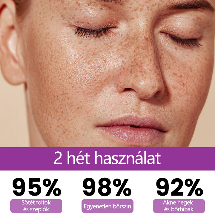 ✨Ceoerty® MelantraX Advanced Anti-Hyperpigmentáció elleni esszencia