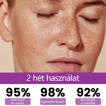 ✨Ceoerty® MelantraX Advanced Anti-Hyperpigmentáció elleni esszencia