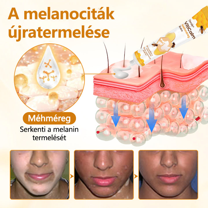 Timilk® VitiCalm méhméreg-krém🌻
