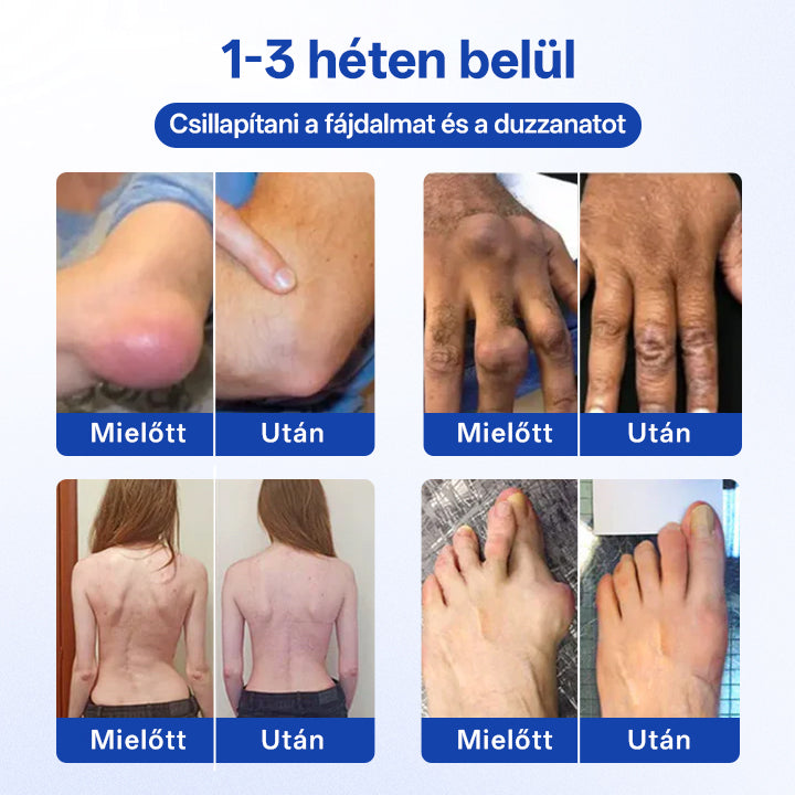 🔥Timilk® BPC-157 Roll-on gél ízületi és csontregenerációhoz