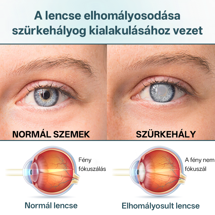 ✅✅✅Timilk® OptiFusion Nano szemcsepp szérum🎉