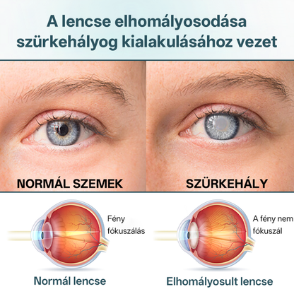 ✅✅✅Timilk® OptiFusion Nano szemcsepp szérum🎉