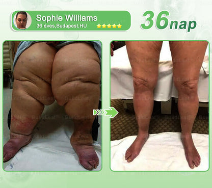 🌿BuildLeaf®🥇 GLP-1 8-az-1-ben Fit &amp; Vital Orális Oldat (Csak napi egyszer, látható változások 7 nap alatt)  Elhízásra, szív- és érrendszeri egészségre, cukorbetegségre, alvási apnoéra, emésztőrendszeri egészségre, ízületi problémákra és még sok másra