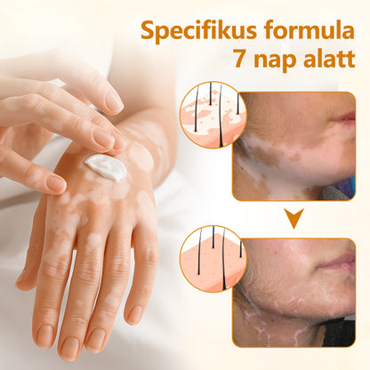 Timilk® VitiCalm méhméreg-krém🌻