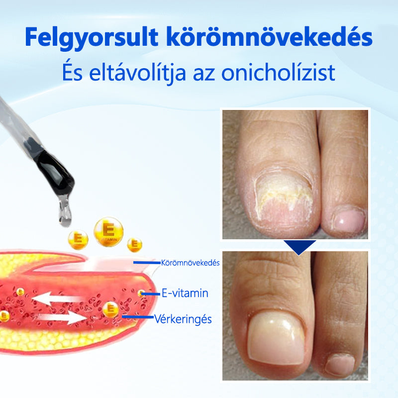 Biancat® OnyxoGuard Serum do wzrostu i naprawy paznokci🔥🔥
