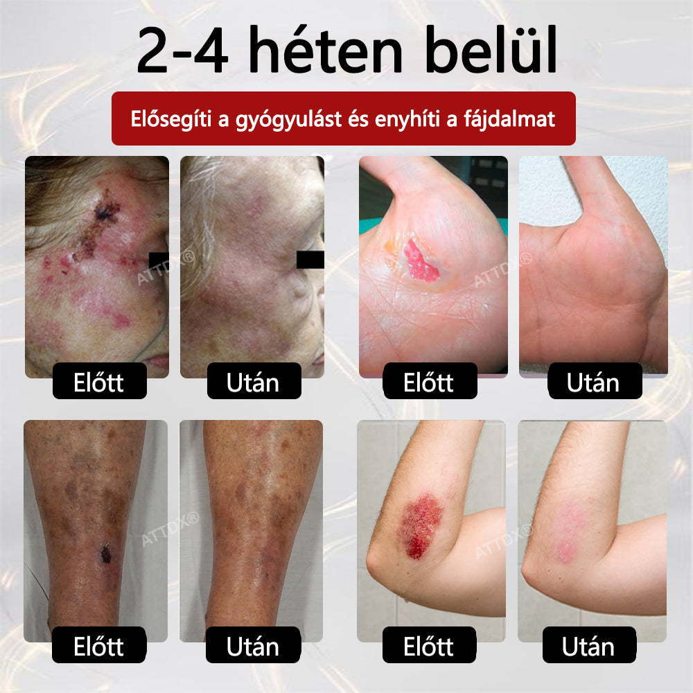 ⭐ATTDX® GlucoseGuard bőrmentő krém