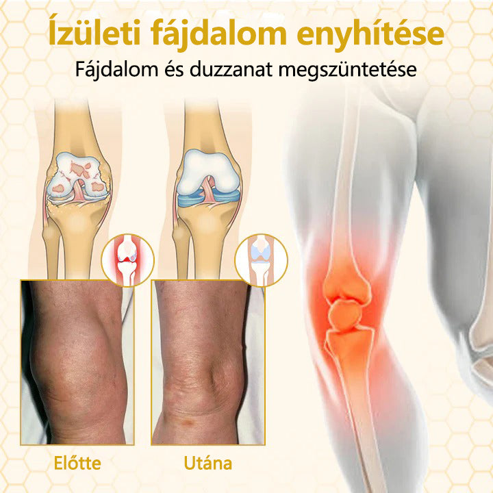 🔥🔥Timilk® VenomFlex méhterápiás krém