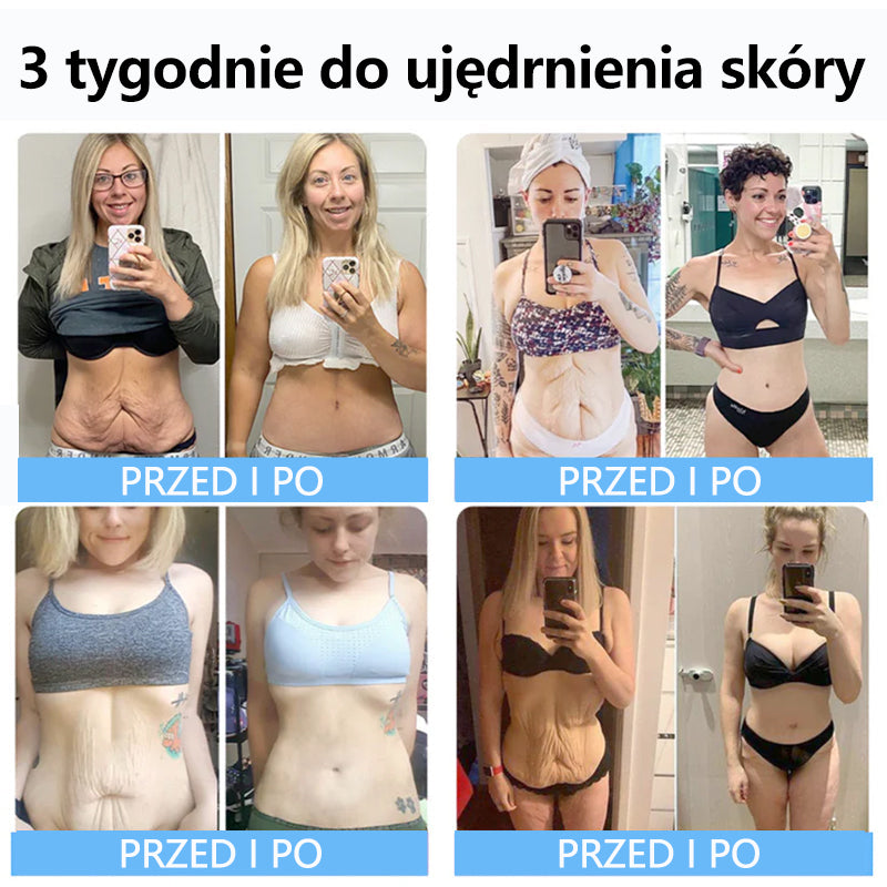 TLOPA™ Collagen Peptide Firming Serum Stick 🎄🎄 - Az Országos Közegészségügyi és Gyógyszerészeti Központ (NCPHP) és a Magyar Bőrgyógyászati Társaság (MDT) a legmagasabb minőségi és biztonsági garanciát nyújtja bőrének. 🔥