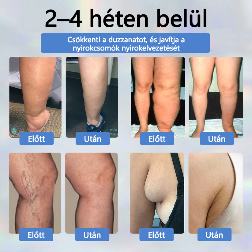 👨‍⚕️👨‍⚕️👨‍⚕️ATTDX® Növényi ödéma enyhítő krém nigellával