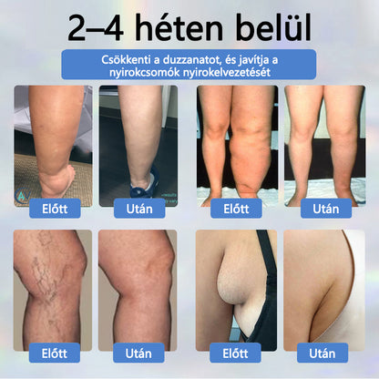 👨‍⚕️👨‍⚕️👨‍⚕️ATTDX® Növényi ödéma enyhítő krém nigellával