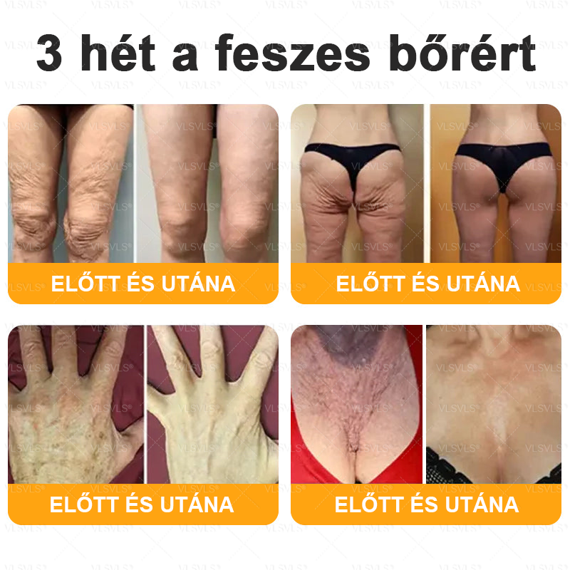 ✨✨✨✨VLSVLS® Méhméreg Átfogó Krém (Minden korosztály számára alkalmas & HSME ajánlja)