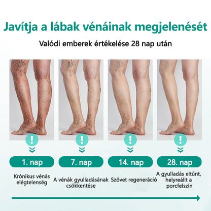Timilk® LegRenew Visszér Tapasz