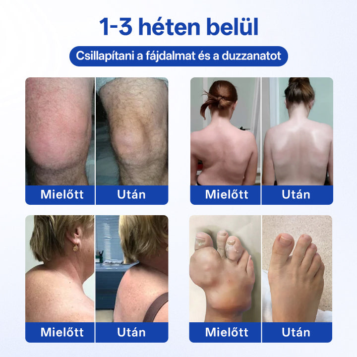 🔥Timilk® BPC-157 Roll-on gél ízületi és csontregenerációhoz