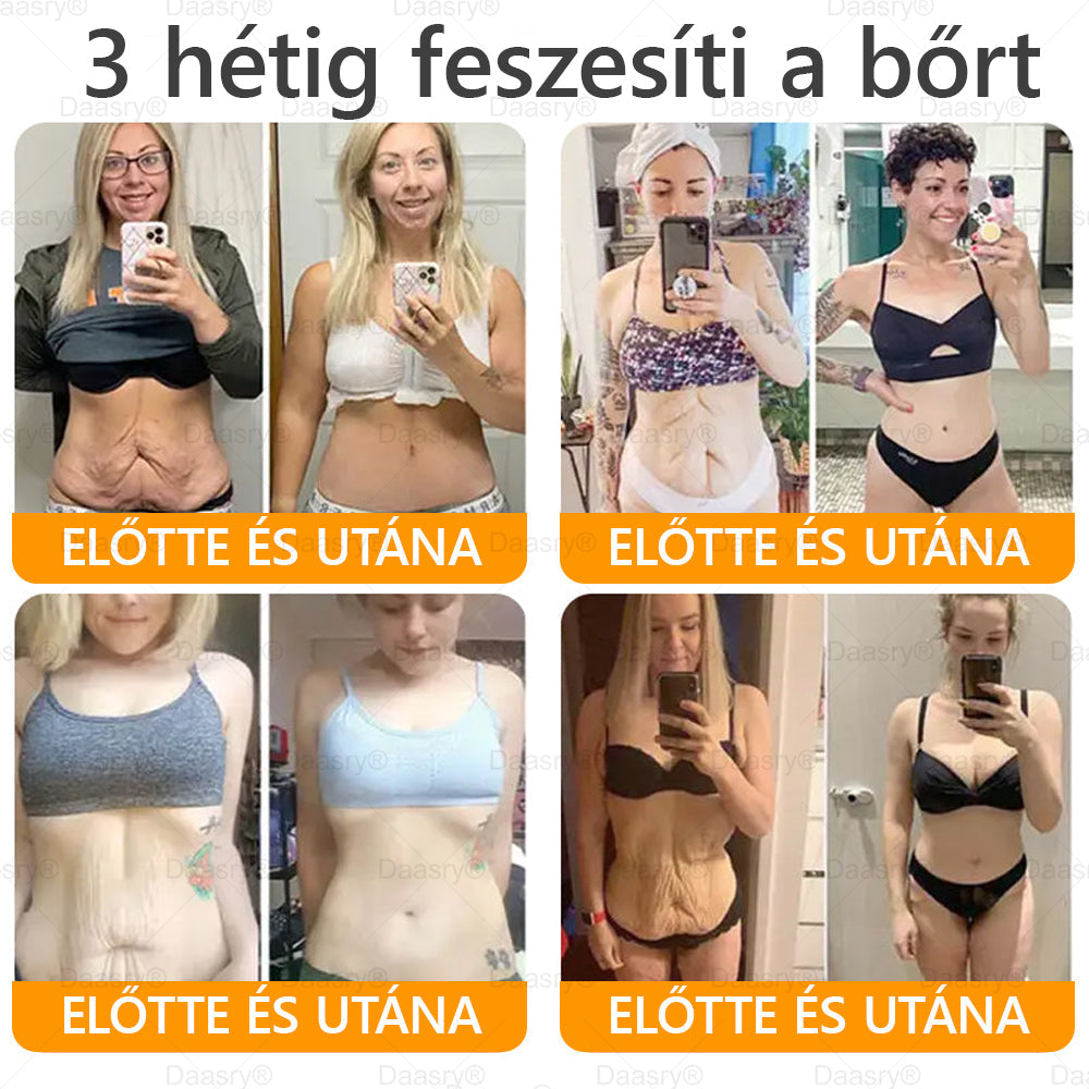 Daasry® Méhméreg Krém – Természetes bőrfeszesítés és ránctalanítás klinikai hatékonysággal! ✨