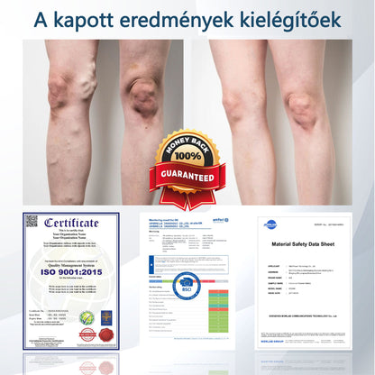 👨‍⚕️👨‍⚕️👨‍⚕️ATTDX® Növényi ödéma enyhítő krém nigellával