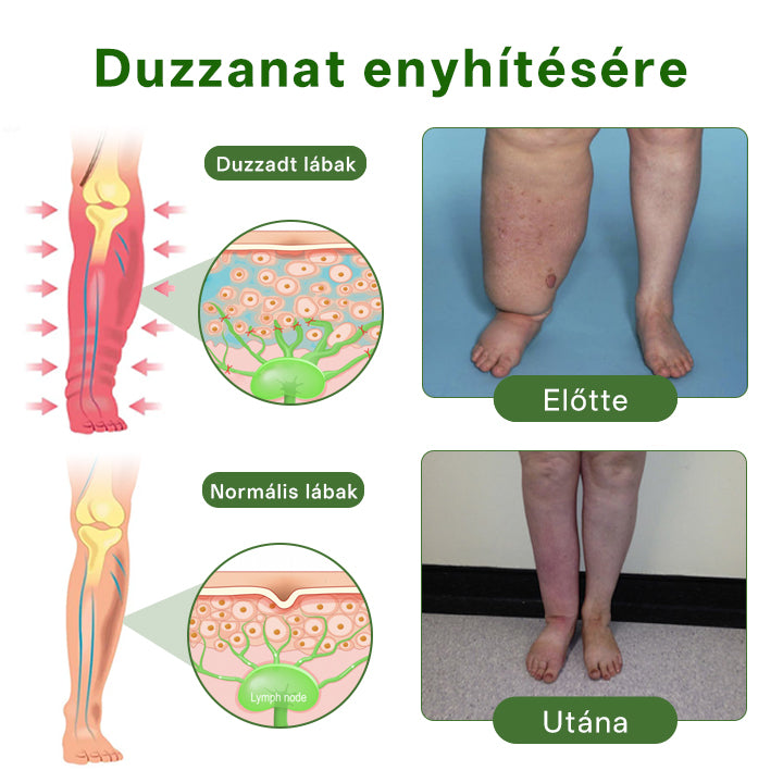 🌿🌿🌿Timilk® professzionális lábápoló krém