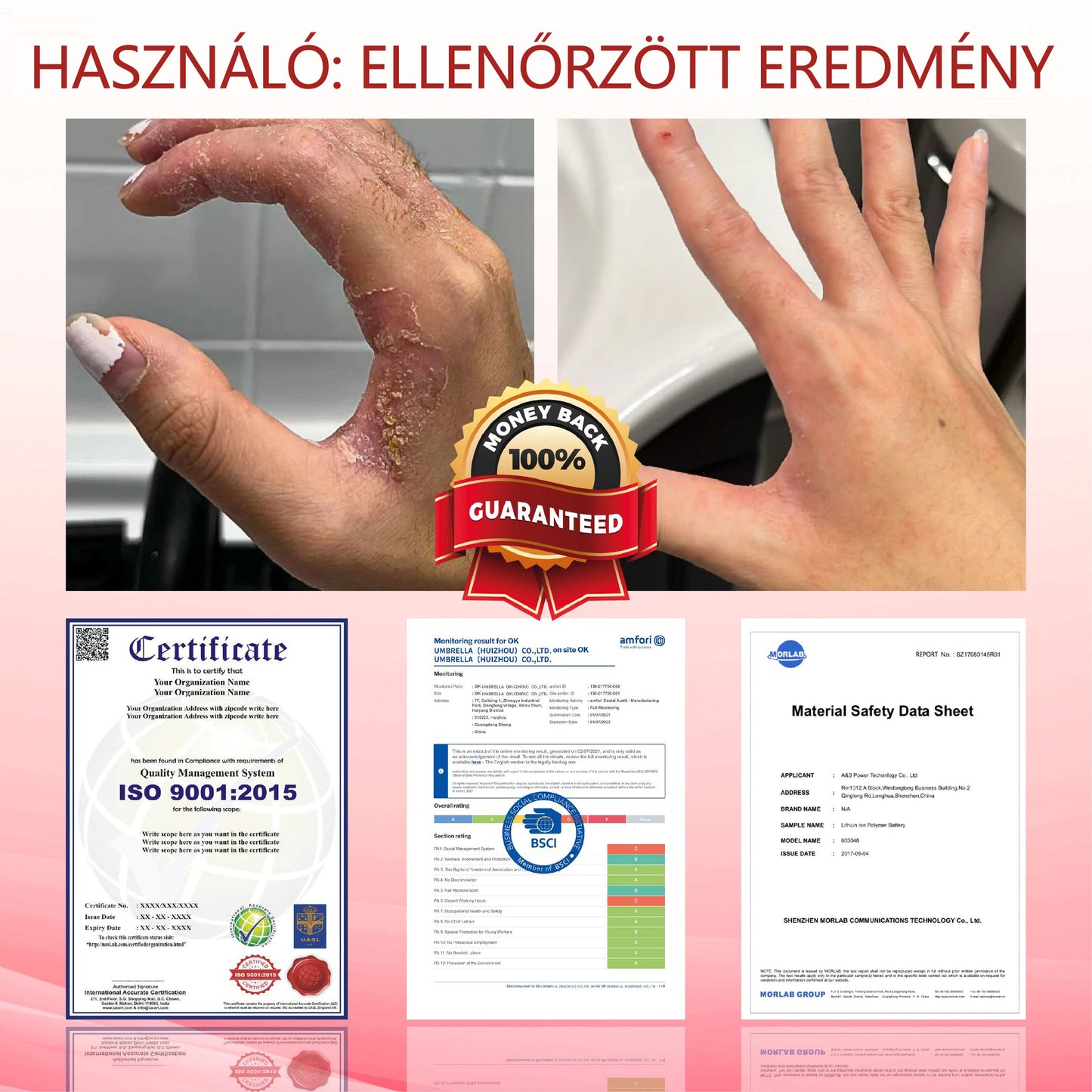 ⭐ATTDX® GlucoseGuard bőrmentő krém