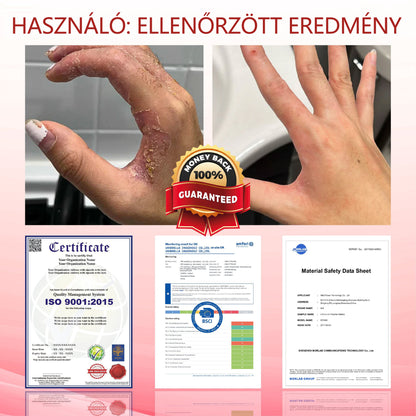 ⭐ATTDX® GlucoseGuard bőrmentő krém