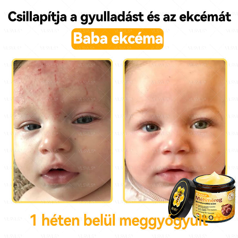 💪VLSVLS® Méhméreg Bőrhelyreállító Krém (👨‍⚕‍CE jóváhagyott)👍✅