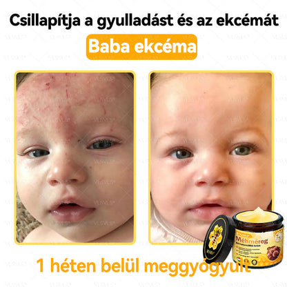 💪VLSVLS® Méhméreg Bőrhelyreállító Krém (👨‍⚕‍CE jóváhagyott)👍✅