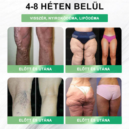 🌿BuildLeaf®🥇 GLP-1 8-az-1-ben Fit &amp; Vital Orális Oldat (Csak napi egyszer, látható változások 7 nap alatt)  Elhízásra, szív- és érrendszeri egészségre, cukorbetegségre, alvási apnoéra, emésztőrendszeri egészségre, ízületi problémákra és még sok másra