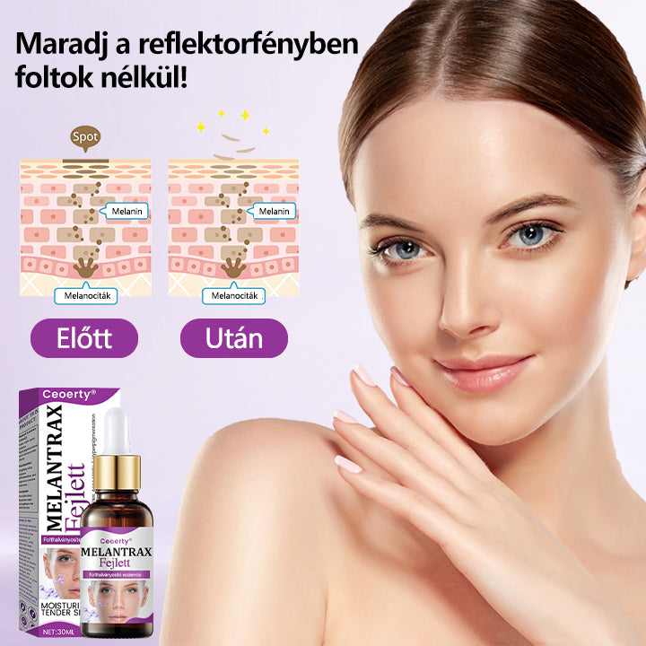 ✨Ceoerty® MelantraX Advanced Anti-Hyperpigmentáció elleni esszencia
