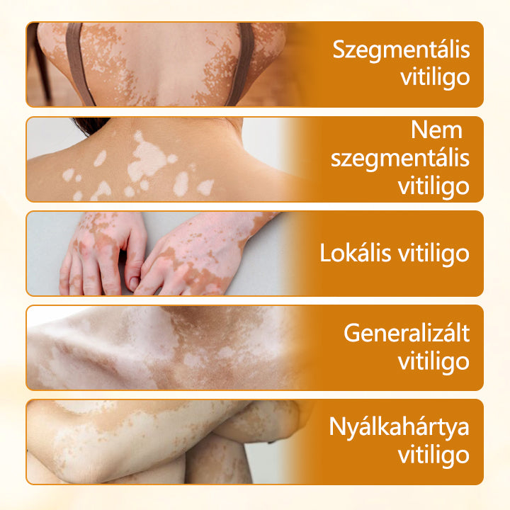 Timilk® VitiCalm méhméreg-krém🌻