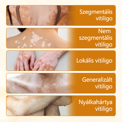 Timilk® VitiCalm méhméreg-krém🌻