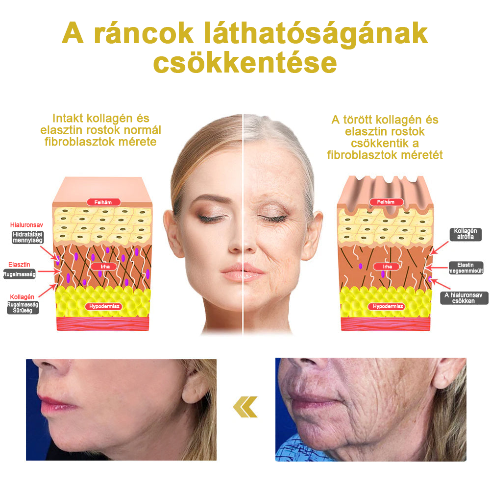 2025. évi Readers' Choice-díjasok🏆 𝐌𝐨𝐨𝐧𝐝𝐚𝐫™ 𝐟𝐞𝐬𝐳𝐞𝐬í𝐭ő 𝐟𝐢𝐚𝐭𝐚𝐥í𝐭ó 𝐤𝐫é𝐦: 𝐕𝐢𝐬𝐬𝐳𝐚á𝐥𝐥í𝐭𝐣𝐚 𝐚 𝐛ő𝐫 𝐫𝐮𝐠𝐚𝐥𝐦𝐚𝐬𝐬á𝐠á𝐭