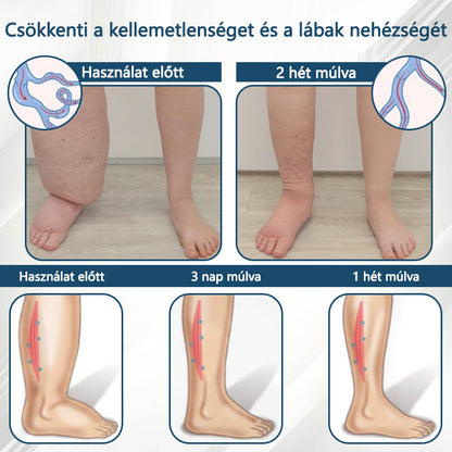 👨‍⚕️👨‍⚕️👨‍⚕️ATTDX® Növényi ödéma enyhítő krém nigellával
