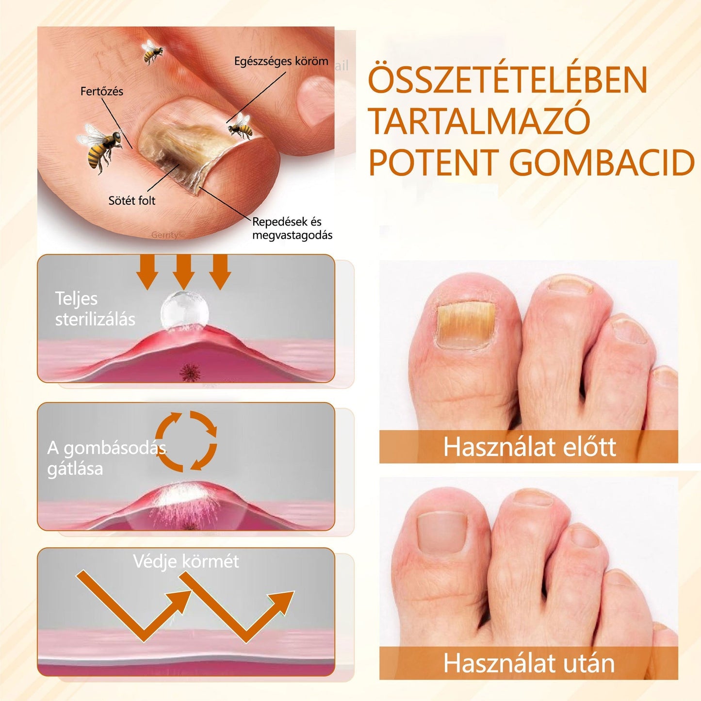Croaie® Fungiclear Bee Therapy Nail Spray🎁🎁🎁