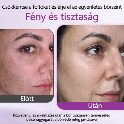 ✨Ceoerty® MelantraX Advanced Anti-Hyperpigmentáció elleni esszencia