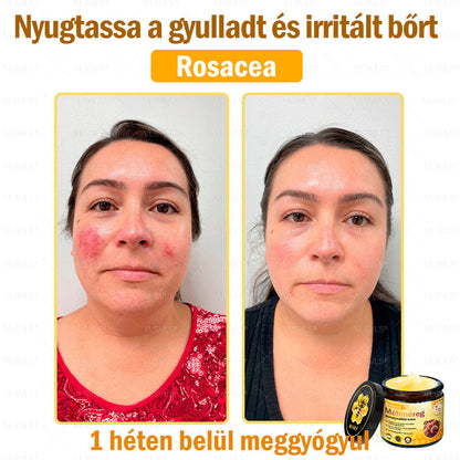💪VLSVLS® Méhméreg Bőrhelyreállító Krém (👨‍⚕‍CE jóváhagyott)👍✅