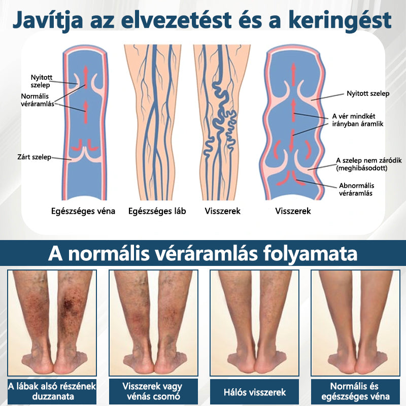 👨‍⚕️👨‍⚕️👨‍⚕️ATTDX® Növényi ödéma enyhítő krém nigellával