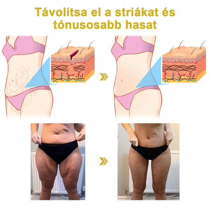 2025. évi Readers' Choice-díjasok🏆 𝐌𝐨𝐨𝐧𝐝𝐚𝐫™ 𝐟𝐞𝐬𝐳𝐞𝐬í𝐭ő 𝐟𝐢𝐚𝐭𝐚𝐥í𝐭ó 𝐤𝐫é𝐦: 𝐕𝐢𝐬𝐬𝐳𝐚á𝐥𝐥í𝐭𝐣𝐚 𝐚 𝐛ő𝐫 𝐫𝐮𝐠𝐚𝐥𝐦𝐚𝐬𝐬á𝐠á𝐭