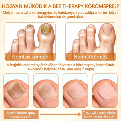 Croaie® Fungiclear Bee Therapy Nail Spray🎁🎁🎁