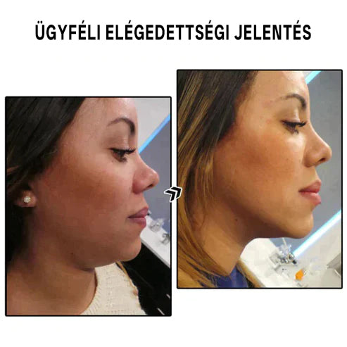 (Utolsó nap a 80% kedvezménnyel) Bikenda™ Lymphvity MagneTherapy Germanium fülbevalók🔥
