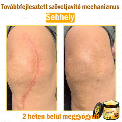 💪VLSVLS® Méhméreg Bőrhelyreállító Krém (👨‍⚕‍CE jóváhagyott)👍✅
