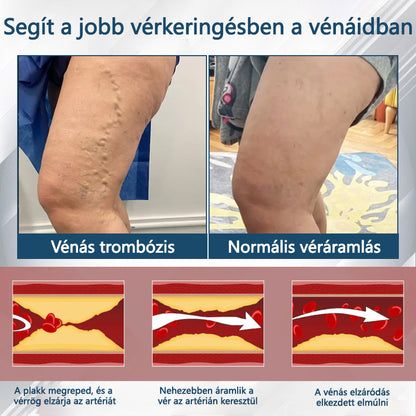 👨‍⚕️👨‍⚕️👨‍⚕️ATTDX® Növényi ödéma enyhítő krém nigellával