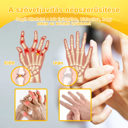 Aeehfeng™ méhméreg és kurkuma ízületi gyulladás terápiás krém (👩 🔬ortopédiai állapotokra és ízületi fájdalmakra👩 🔬 specializálódott)