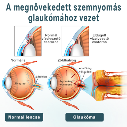 ✅✅✅Timilk® OptiFusion Nano szemcsepp szérum🎉