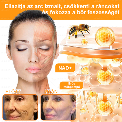 ✨✨✨✨VLSVLS® Méhméreg Átfogó Krém (Minden korosztály számára alkalmas & HSME ajánlja)