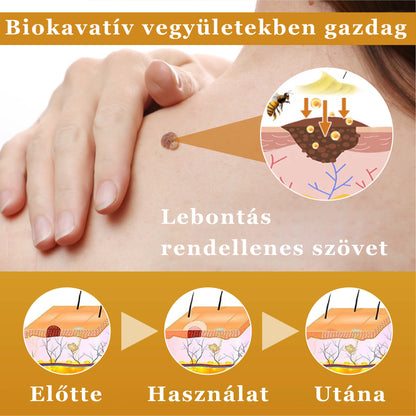 Croaie® Mellifera-méreg sűrítése bőrregeneráló krém💖